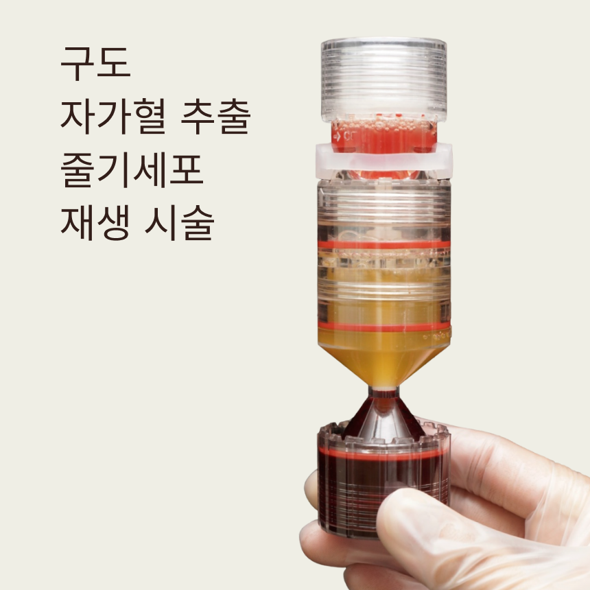 구도 자가혈 추출 줄기세포 재생 시술 | 피부 스스로 회복하는 힘을 되찾는 방법