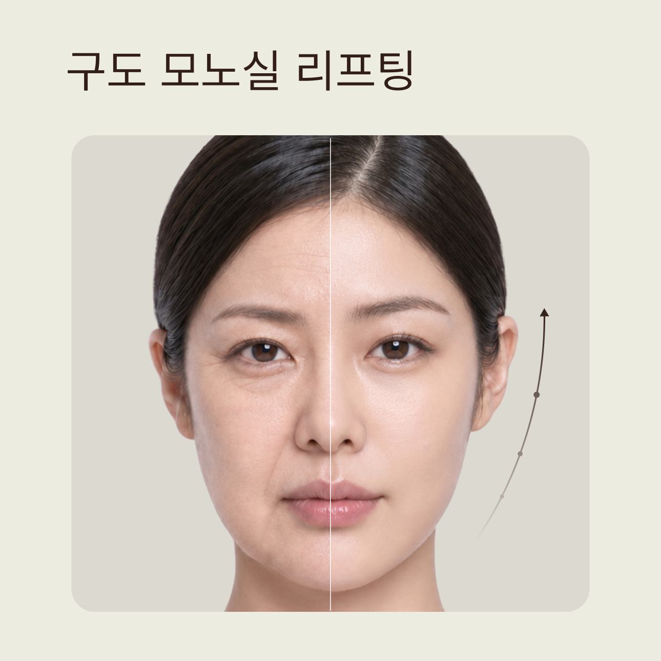 구도 모노실 리프팅 | 피부 스스로 탄력과 밀도를 회복하는 리프팅의 정수