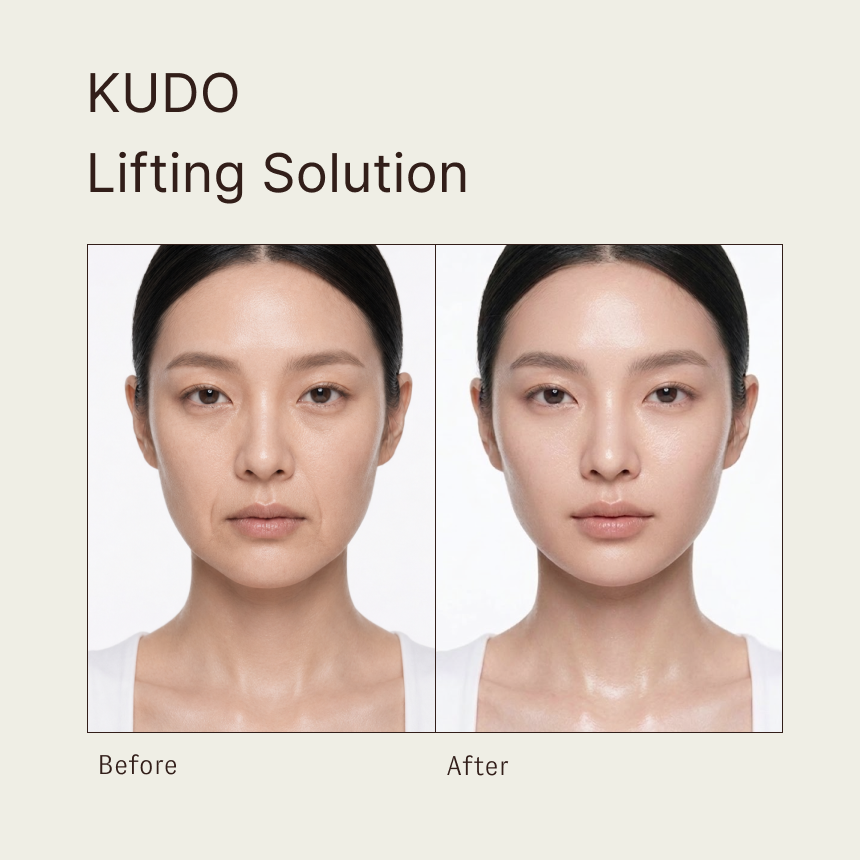 KUDO Lifting Solution | Non-Thermal Resonance Full-Layer Stimulation