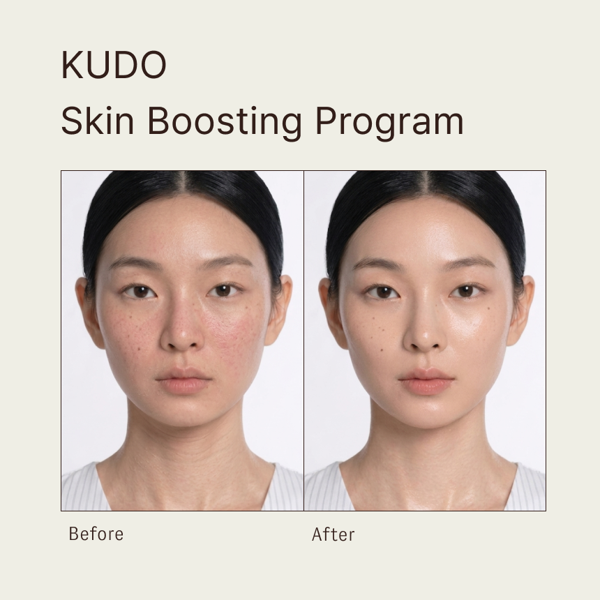 KUDO Skin Boosting Program