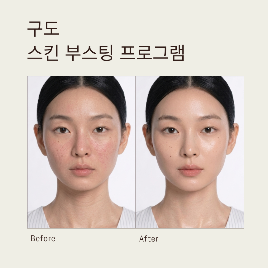 구도 스킨 부스팅 프로그램