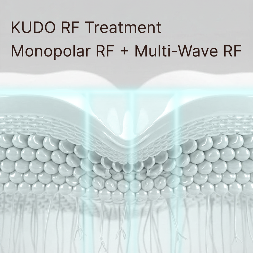 KUDO RF Treatment | Monopolar RF + Multi-Wave RF